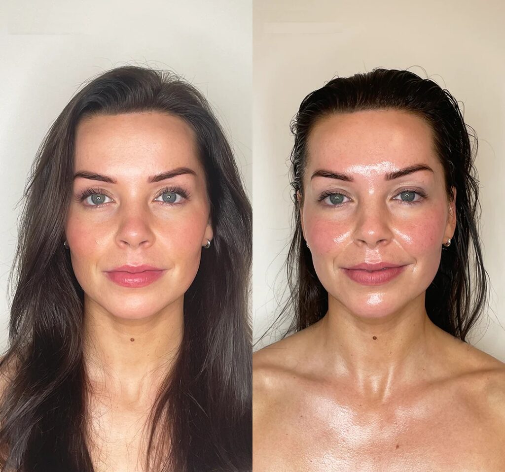 Before_After_4_-_week_2_Front_0bd6b53a-ea32-4524-9b9c-2ed11cfe923e